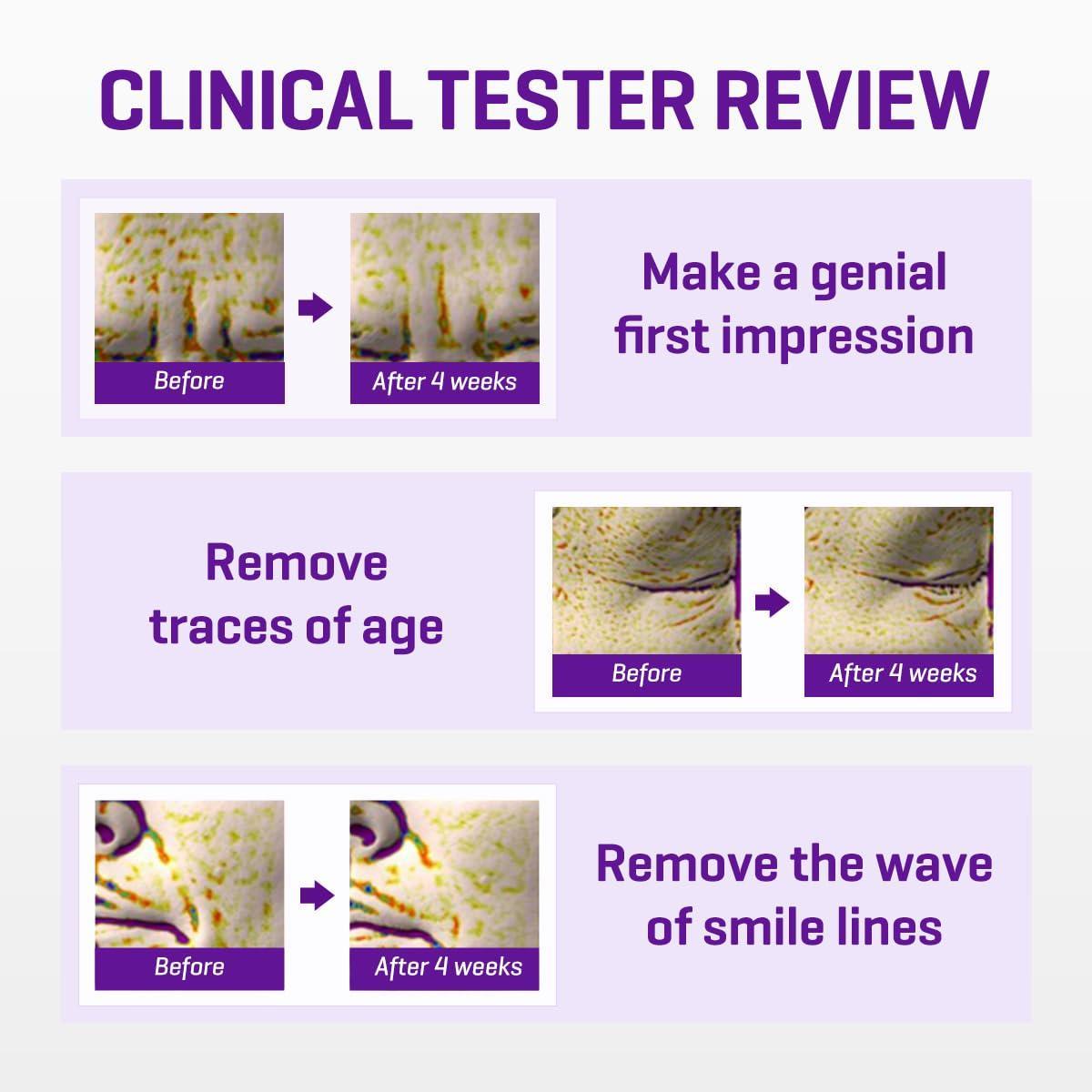 SomeByMi – Retinol Intense Advanced Triple Action Eye Cream 30 ml